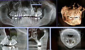 An array of dental x-rays